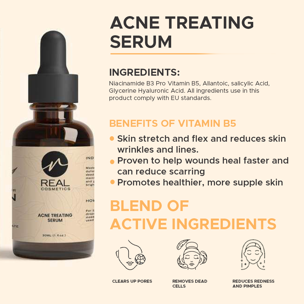 ACNE TREATING SERUM - 30 ml